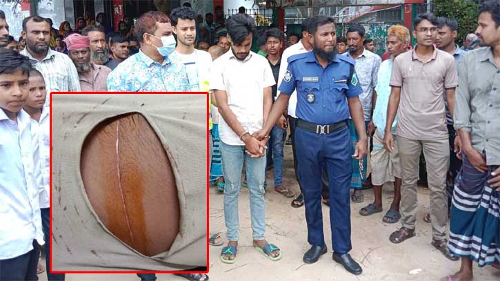 ছাত্রীকে উত্ত্যক্তের প্রতিবাদ করায় দপ্তরিকে ছুরিকাঘাত ছাত্রীকে উত্ত্যক্তের প্রতিবাদ করায় দপ্তরিকে ছুরিকাঘাত